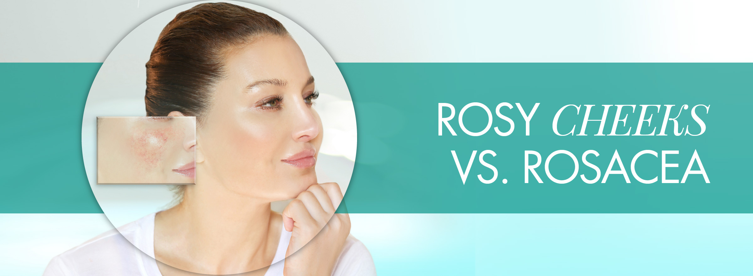 Is it Rosy Cheeks, or is it Rosacea? Hodge Dermatology
