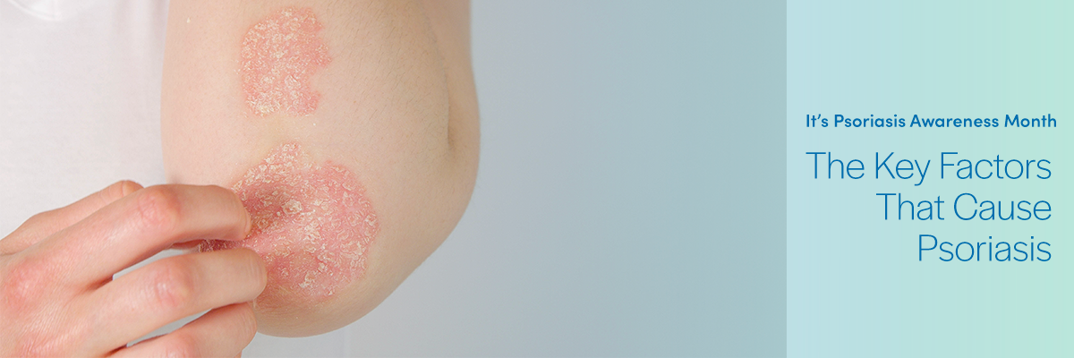 The Key Factors That Cause Psoriasis Conejo Dermatology